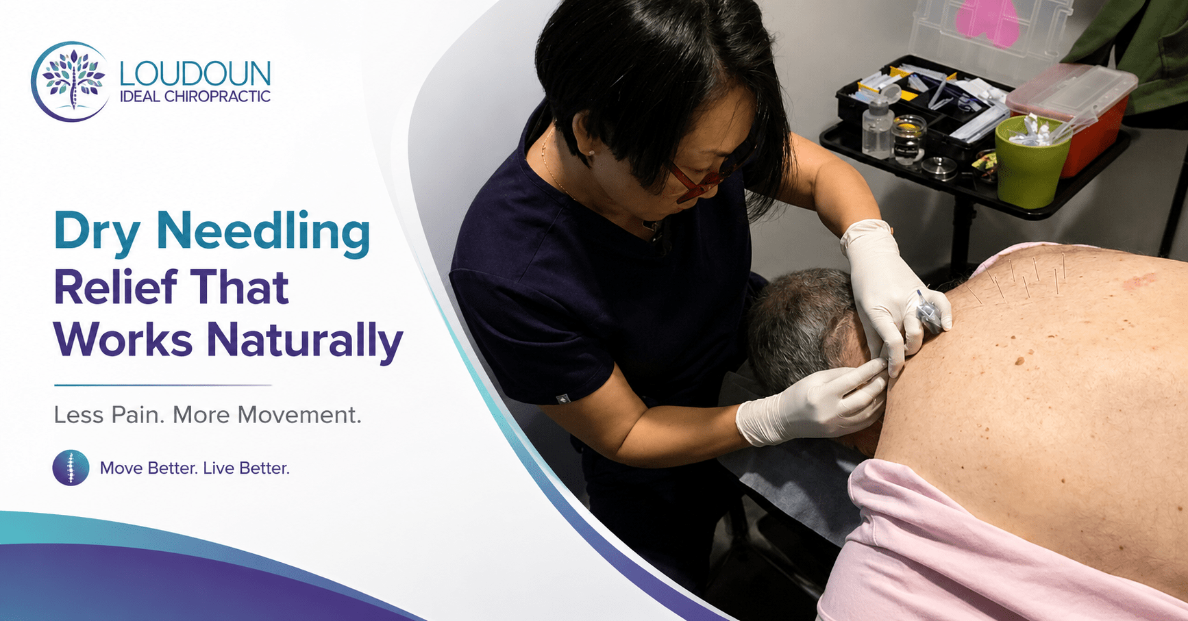 Does Dry Needling Hurt